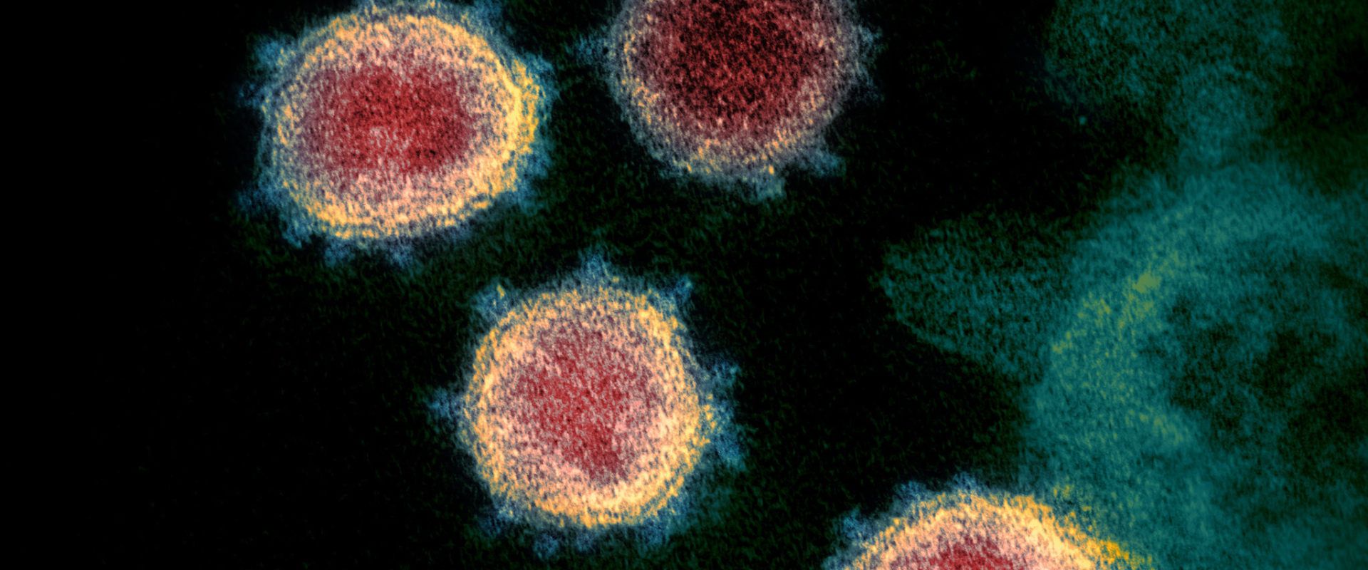 Can You Catch COVID-19 from a Surface?